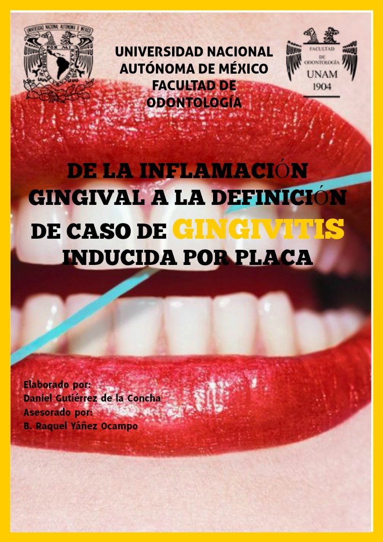 De la inflamación gingival a la definición de caso de gingivitis Vol 1