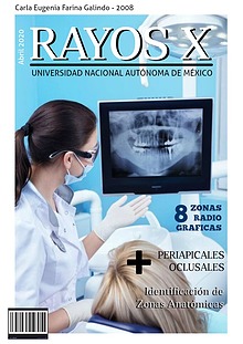 Zonas radiográficas en Odontología