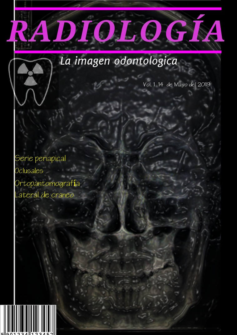 INTERPRETACIONES RADIOGRAFICAS INTERPRETACION RADIOGRAFICAS VOL. 1  14  MAYO 2019