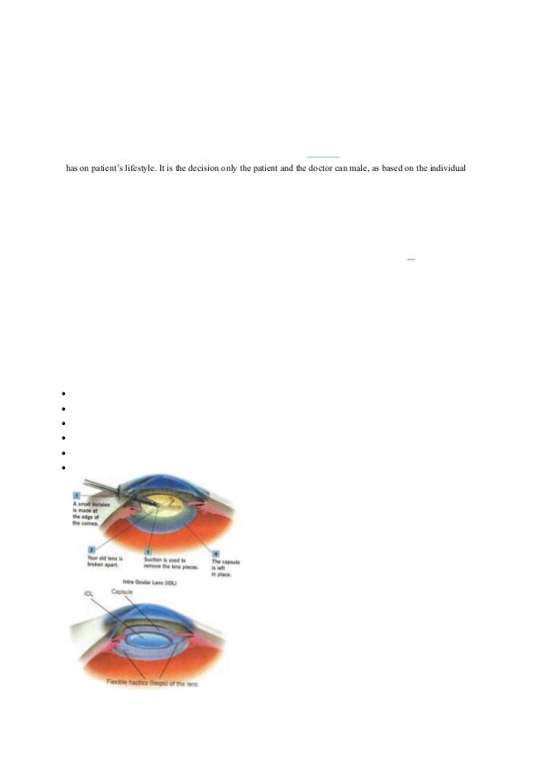 Best Cataract hospital In Mumbai Cataract Treatment In Mumbai