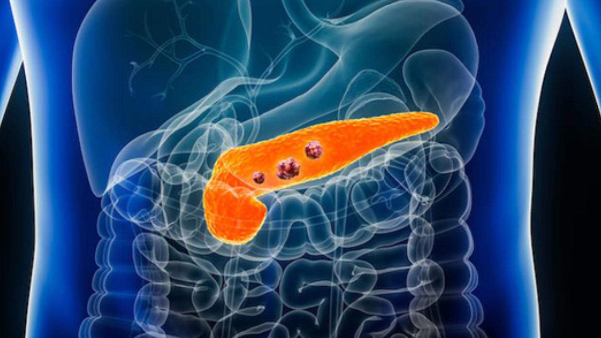 Quest for a Cure banner - Pancreatic cancer illustration